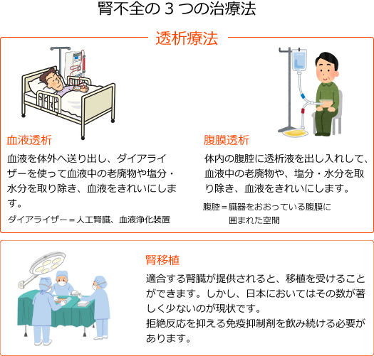 腎不全3つの治療法
血液透析・腹膜透析・腎移植のイメージイラスト