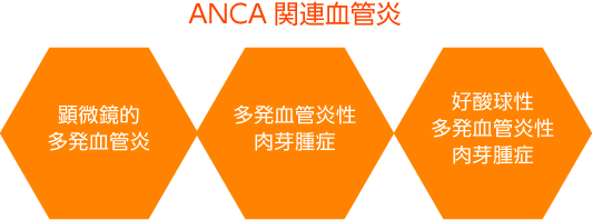 ANCA関連血管炎
・顕微鏡的多発血管炎
・多発血管炎性肉芽腫症
・好酸球性多発血管炎性肉芽腫症