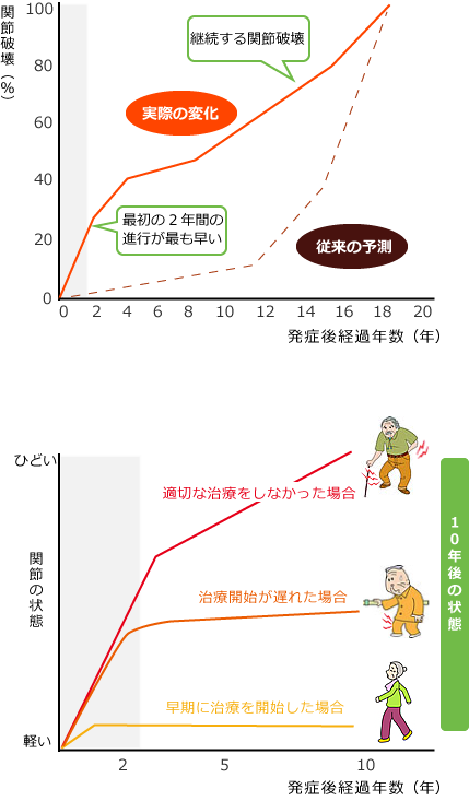 関節破壊と発症後経過年数のグラフ
関節の状態と発症後経過年数のグラフ