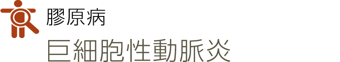 膠原病
巨細胞性動脈炎(旧称：側頭動脈炎)